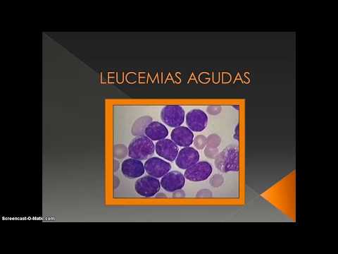 LEUCEMIAS AGUDAS