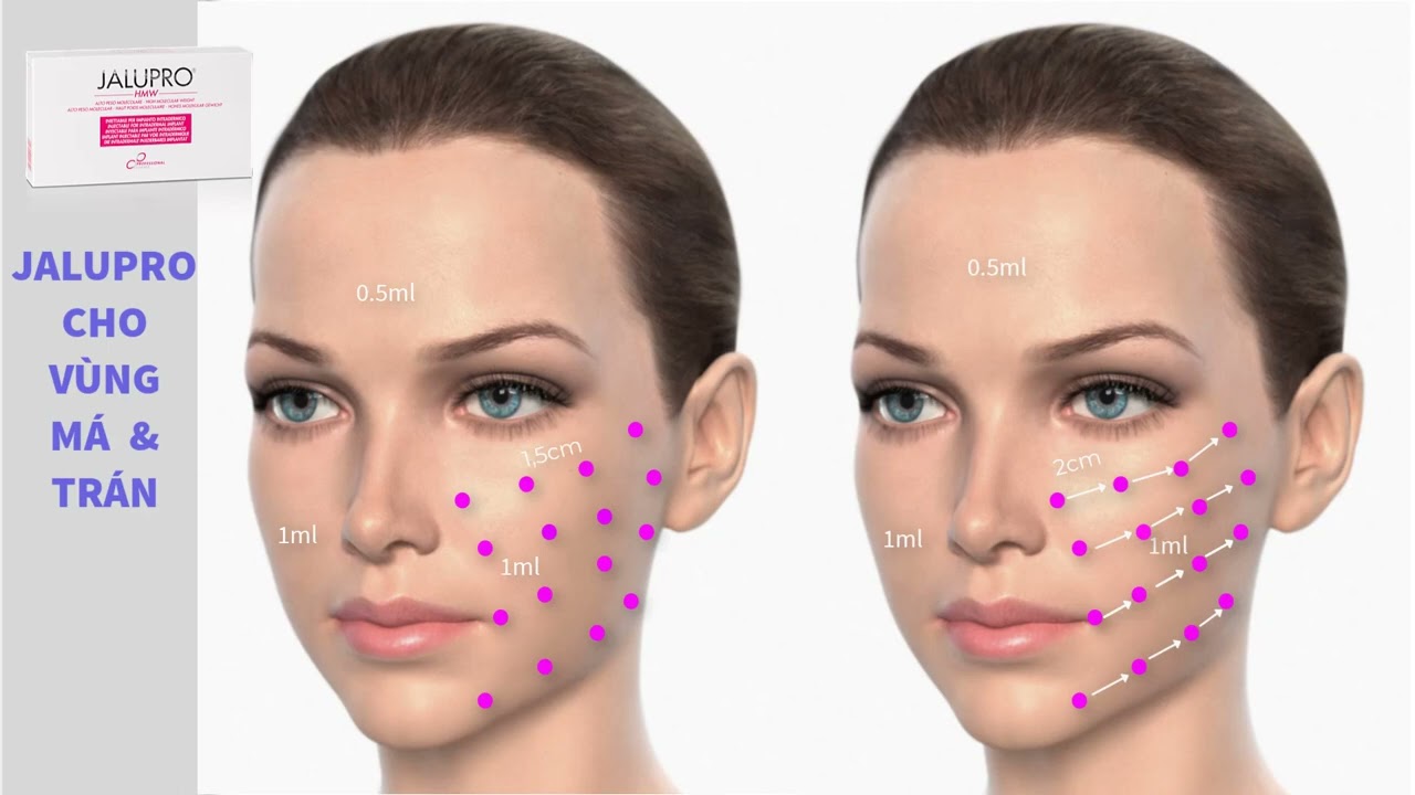 Jalupro: Cách dùng cụ thể theo vùng và theo sản phẩm - Jalupro Việt Nam