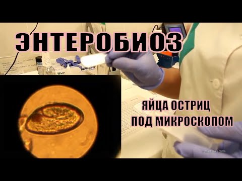 Энтеробиоз. Яйца остриц под микроскопом.Описторхоз. Диагностика паразитов👩🔬⚕