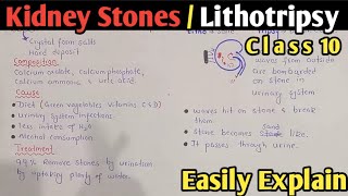 Kidney Stones | Cause, Symptoms And Treatment | Lithotripsy | Class 10 Biology