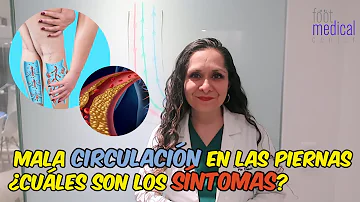 ¿Qué se siente cuando hay poco flujo sanguíneo en las piernas?