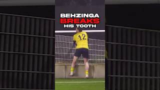BEHZINGA LOSES HIS TOOTH FOREVER?!
