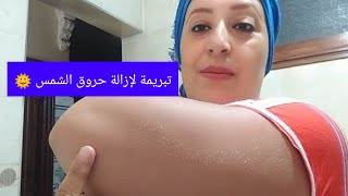 تبريمة واش من تبريمة لإزالة حروق الشمس تبييض وتوحيد اللون