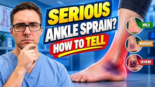 Is Your Ankle Sprain Serious? How to Tell (Podiatrist Guide)