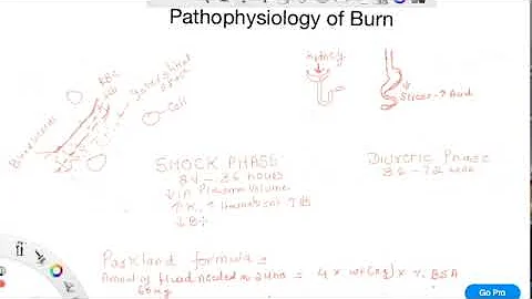 Burn pathophysiology and care