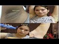 UNDERARMS WHITENING AT HOME||100% EFFECTIVE||INSTANT and FASTEST RESULT||