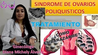 SINDROME DE OVARIOS POLIQUISTICOS, TRATAMIENTO POR GINECOLOGA DIANA ALVAREZ