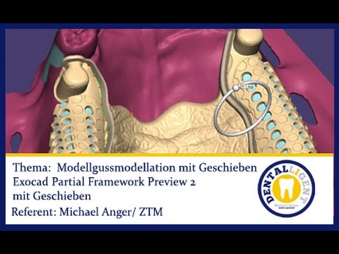 FREE EXOCAD TUTORIAL-FULL MOVIE - Modellgussmodellation mit Geschieben -in voller Länge 28 Min