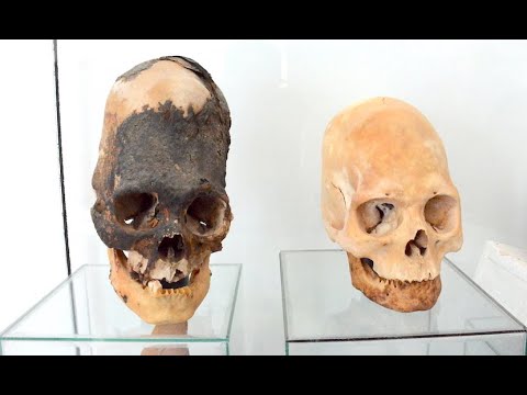 Face to Face with the Elongated Skulls of Paracas