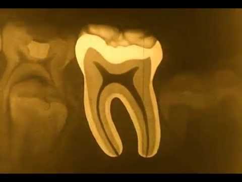 Care of Teeth [Silent] (Eastman Teaching Films, Inc., 1930)