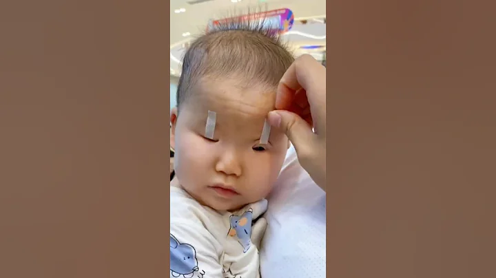 Why do Chinese apply Tape on their Children's Eye🤯