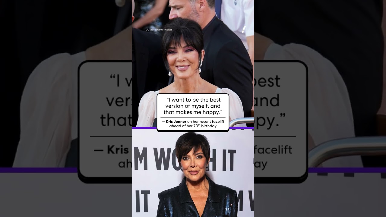 Kris Jenner breaks her silence on recent facelift