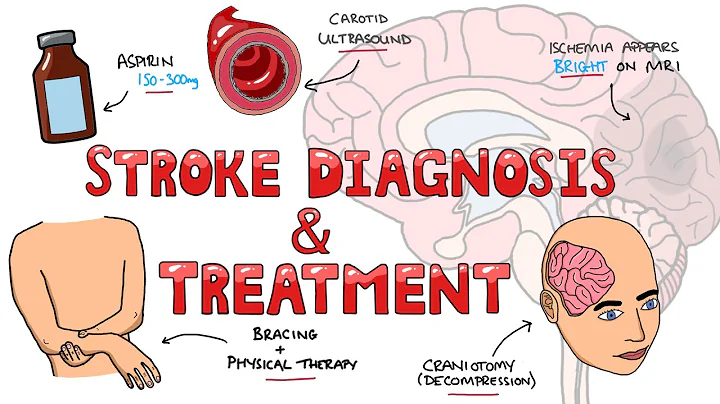 Stroke Diagnosis and Treatment - Acute and Long Term Treatment of Ischemic and Hemorrhagic Stroke - DayDayNews