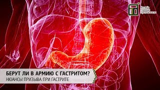 Берут ли в армию с гастритом | Нюансы призыва при гастрите