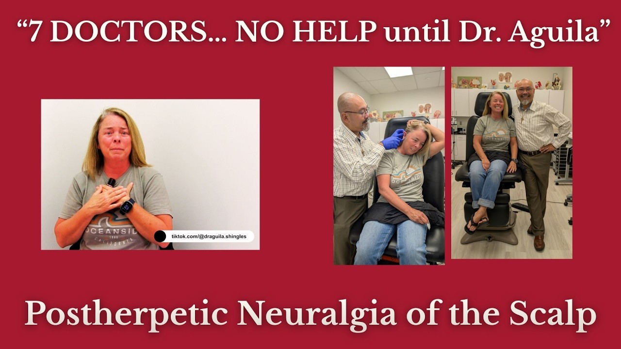 Postherpetic Neuralgia (PHN) of the Scalp: A Life-Changing Recovery