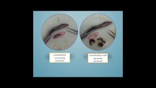 Eels and Nematode Parasites by Zoemma Warshafsky (Virginia Institute of Marine Science)