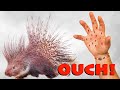 Porcupine Quills Human Hand And How To Remove Them