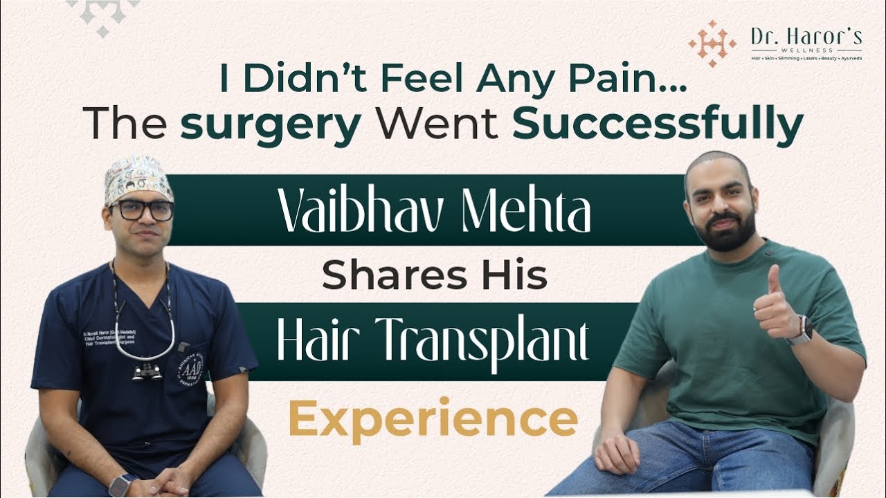 Vaibhav Mehta’s Post 1 Week Hair Transplant Experience | Dr. Navnit Haror