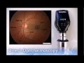 Direct Ophthalmoscopy