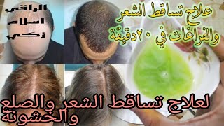 علاج لمنع تساقط الشعر مع الخلطتين العجيبتين في خلال ثلاث ايام فقط عالجي الصلع والخشونة والتقصف