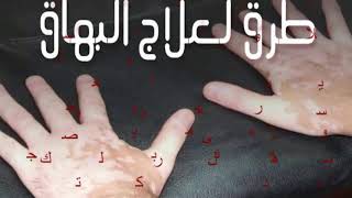 اخيرا علاج البوهاق والجدرى