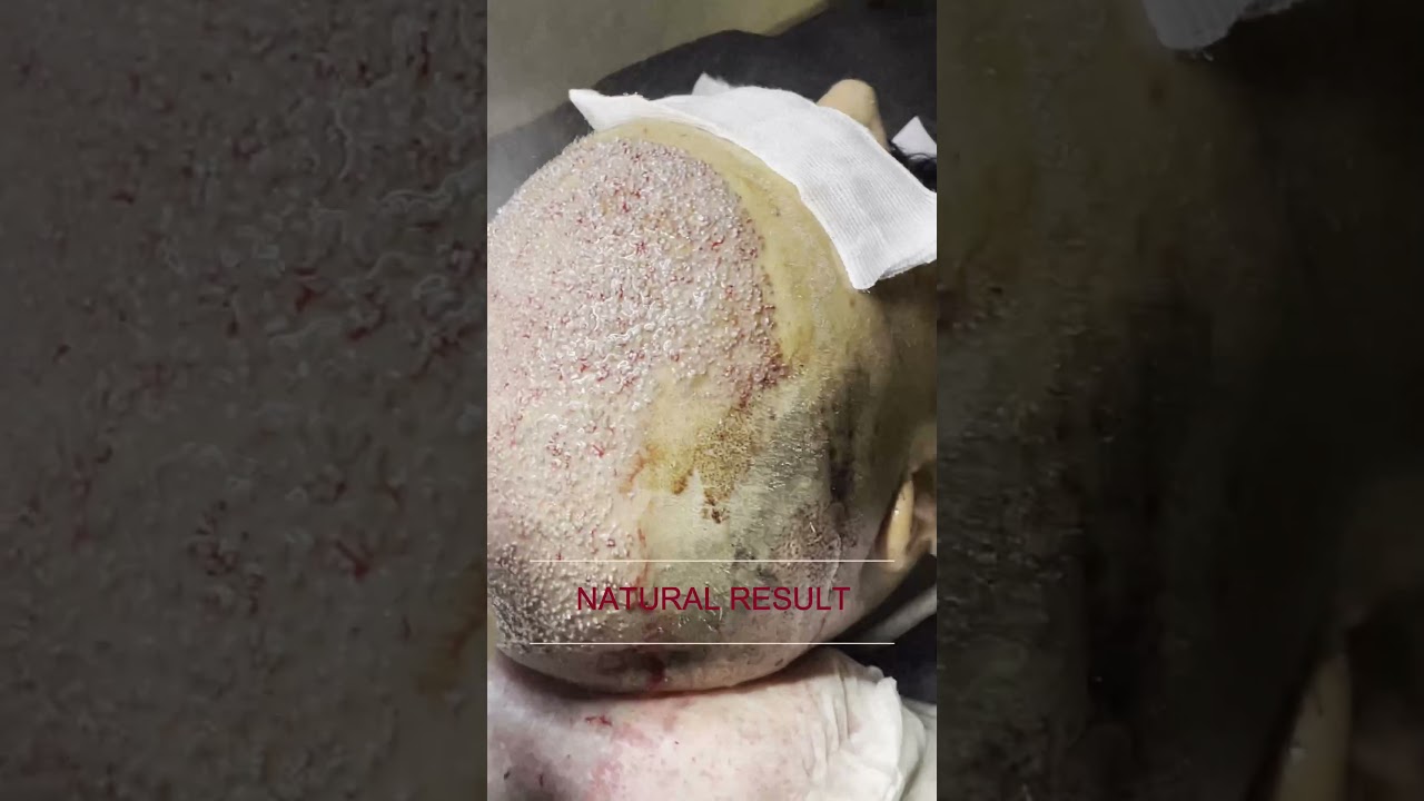 Maximum 2 Vip Operation Per Day