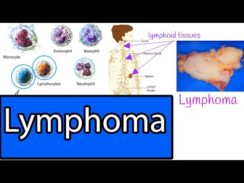 Lymphoma - Types, Most common Lymphomas, Symptoms and treatment