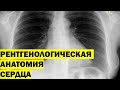Рентгенологическая анатомия сердца |  Анатомия сердца на рентгене