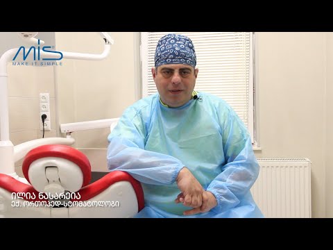ექ. ილია ნასარეია და კბილის იმპლანტაცია ბათუმში. MIS Implants
