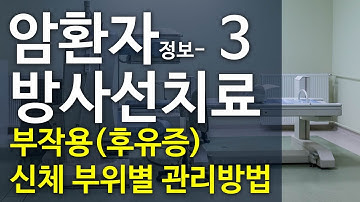 [암환자 정보 리커버리] - 방사선치료 부작용(후유증), 신체 부위별 관리방법