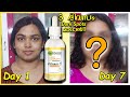 Remove pimple marks fast at home 3ദിവസം കൊണ്ട് മാറാൻ!Garnier Light Complete Vitamin C Booster Serum