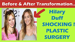 Hilary Duff Plastic Surgery Before and After Full HD