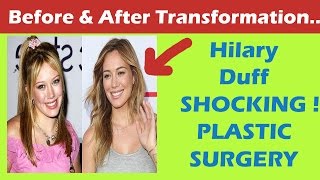 Hilary Duff Plastic Surgery Before and After Full HD