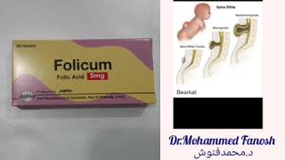 Folic acid and fetal abnormalities  حمض الفوليك و تشوهات الجنين??