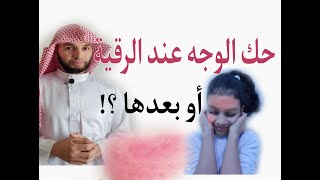 ما هي دوافع حك الوجه بقوة عند سماع الرقية أو بعدها؟ #سحر#مس#عين#حسد