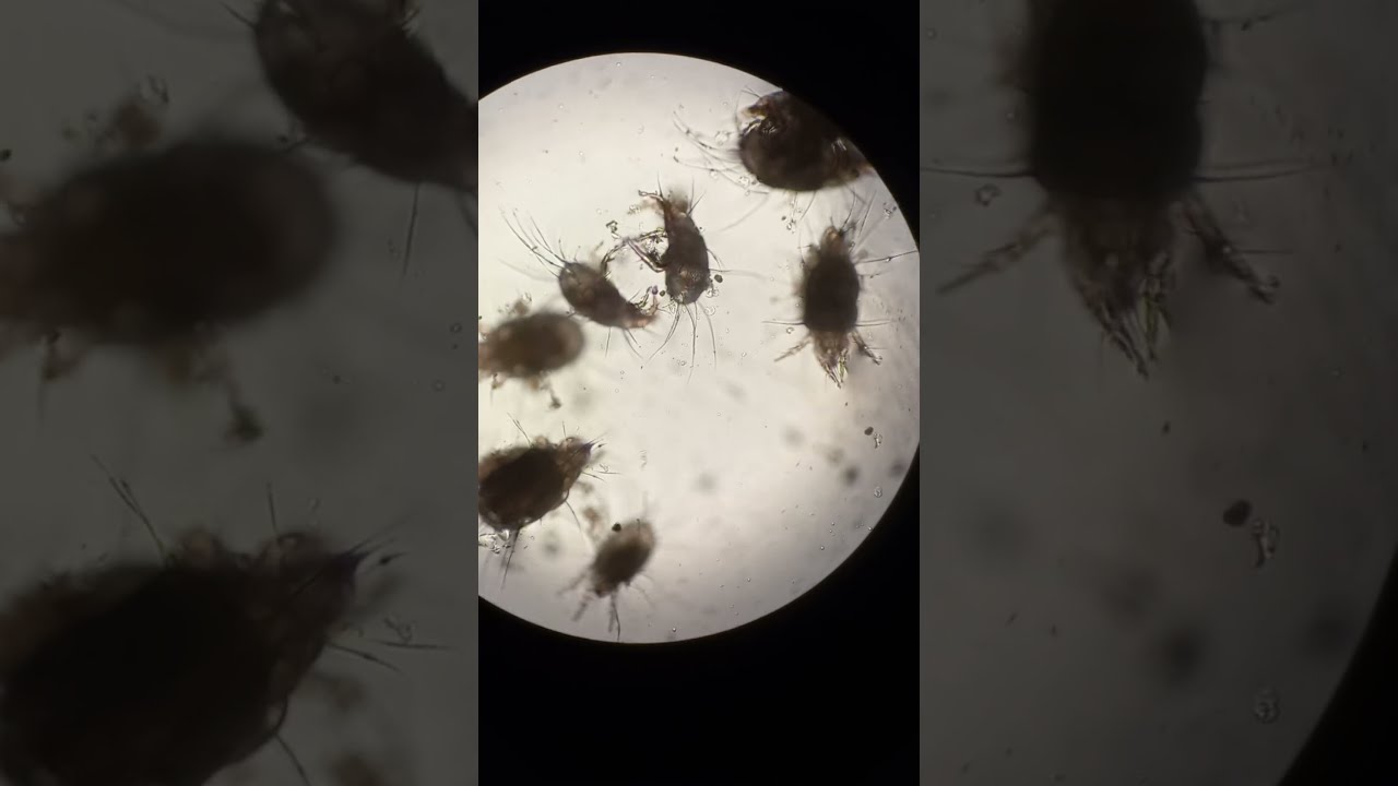 КЛІЩІ АКАРУС ПІД МІКРОСКОПОМ. РОЗМІР 0 5 мм. Acarus Mites, or Tyroglyphus, Acaridae under Micrsocope