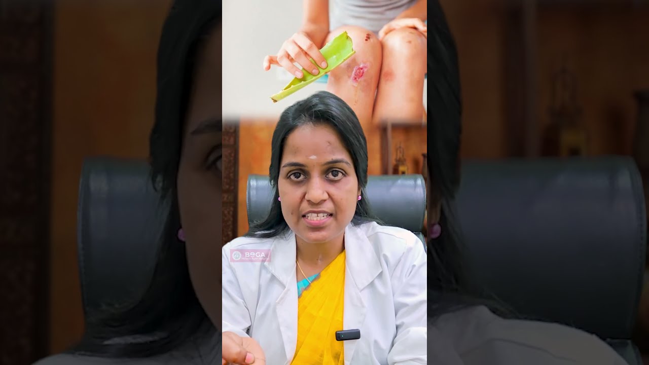 Got Burned While Cooking? Heal It Naturally at Home! 