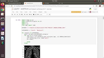 COVID-19 Detection on Chest X-Ray and CT Scan Images of Coronavirus Suspected Population