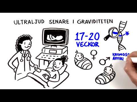 Video: Är Ultraljud Farligt Under Graviditeten