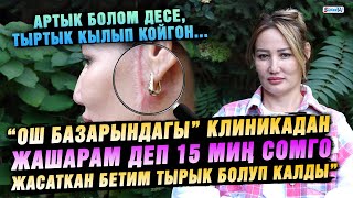 “Ош базарындагы" клиникадан 15000 сомго жасаткан бетим тырык болуп калды" дейт 33 жаштагы келин