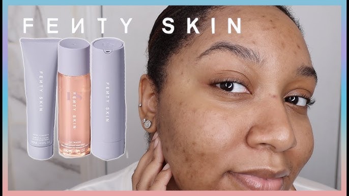 Is Fenty Skin Good for Acne-Prone Skin? — LAKISHA ADAMS