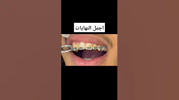اجمل النهايات مرحلة فك التقويم 