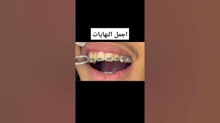 اجمل النهايات مرحلة فك التقويم