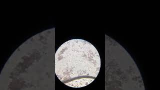 Live bacteria under microscope (400x)