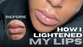 HOW I LIGHTENED MY LIPS IN ONE MONTH (USING ONE KEY INGREDIENT)