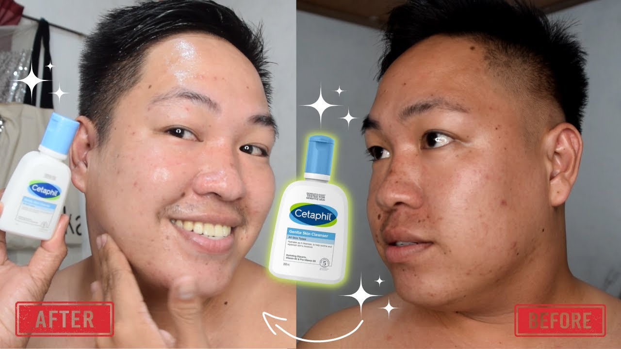 Regan Interaktion Bakterie BEST FACIAL CLEANSER! CETAPHIL GENTLE SKIN CLEANSER REVIEW FOR 3 WEEKS! ANG  WORTH IT GAMITIN!! - YouTube