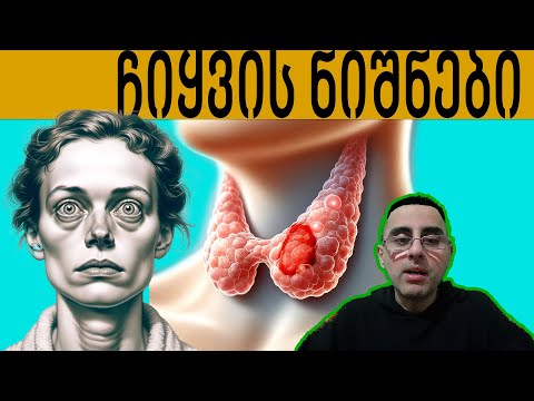 ჩიყვის ტოპ 5 მიზეზი და მკურნალობა