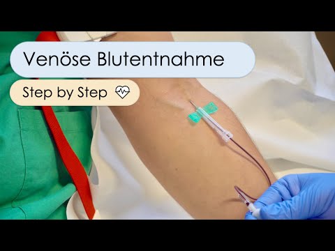 Video: Sollte der Phlebotomist Handschuhe tragen?