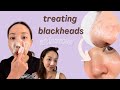 How To Treat Blackheads SAFELY at Home | home remedies for different blackhead concerns