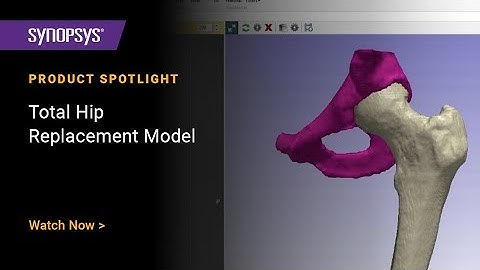 Total Hip Replacement Model in Simpleware